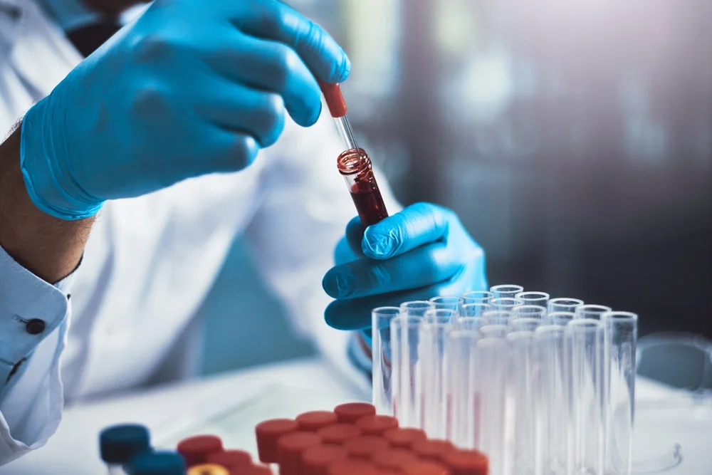 Gloved technician placing a blood sample tube into a rack